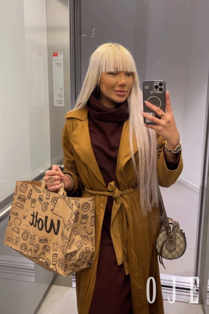 stories-slider-content